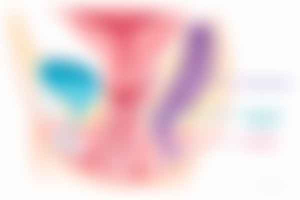 Vulvovaginal candidiasis clinical findings with thick white discharge, erythema and normal cervix