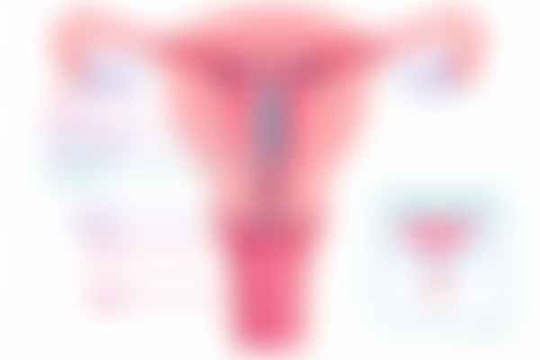 Levonorgestrel intrauterine system for heavy menstrual bleeding