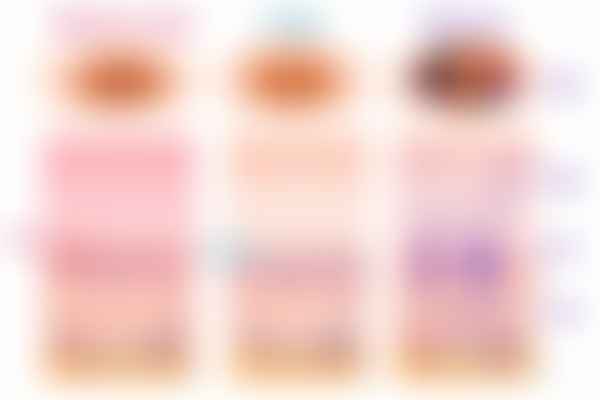 Benign pigmented macules compared with melanoma