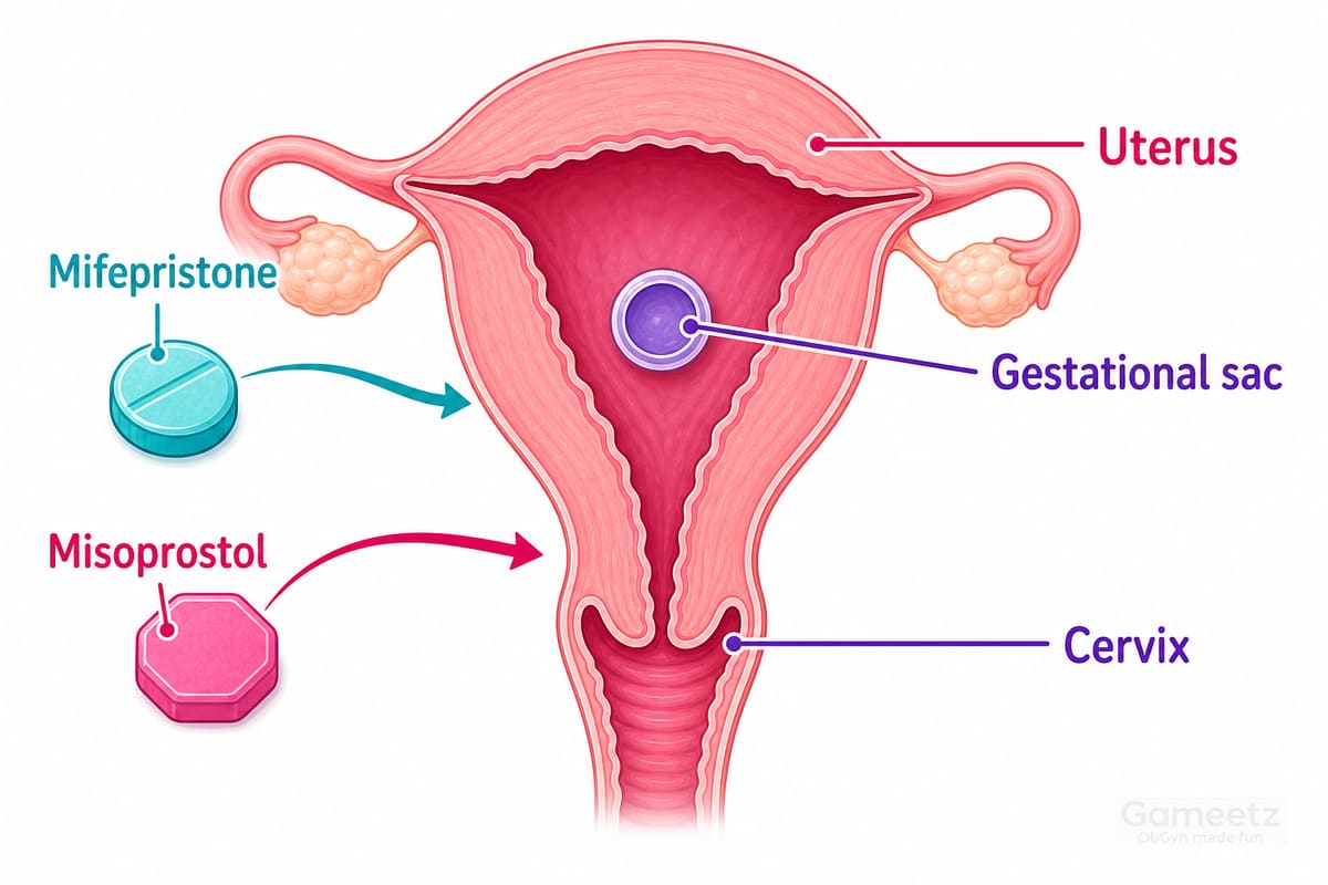 First-trimester medical TOP with labelled uterus, cervix, gestational sac, mifepristone, and misoprostol.